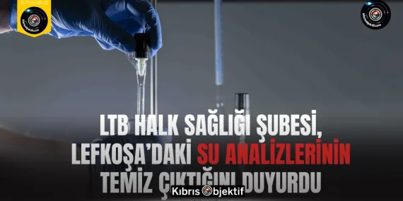 LTB Halk Sağlığı Şubesi, Lefkoşa’daki su analizlerinin temiz çıktığını duyurdu